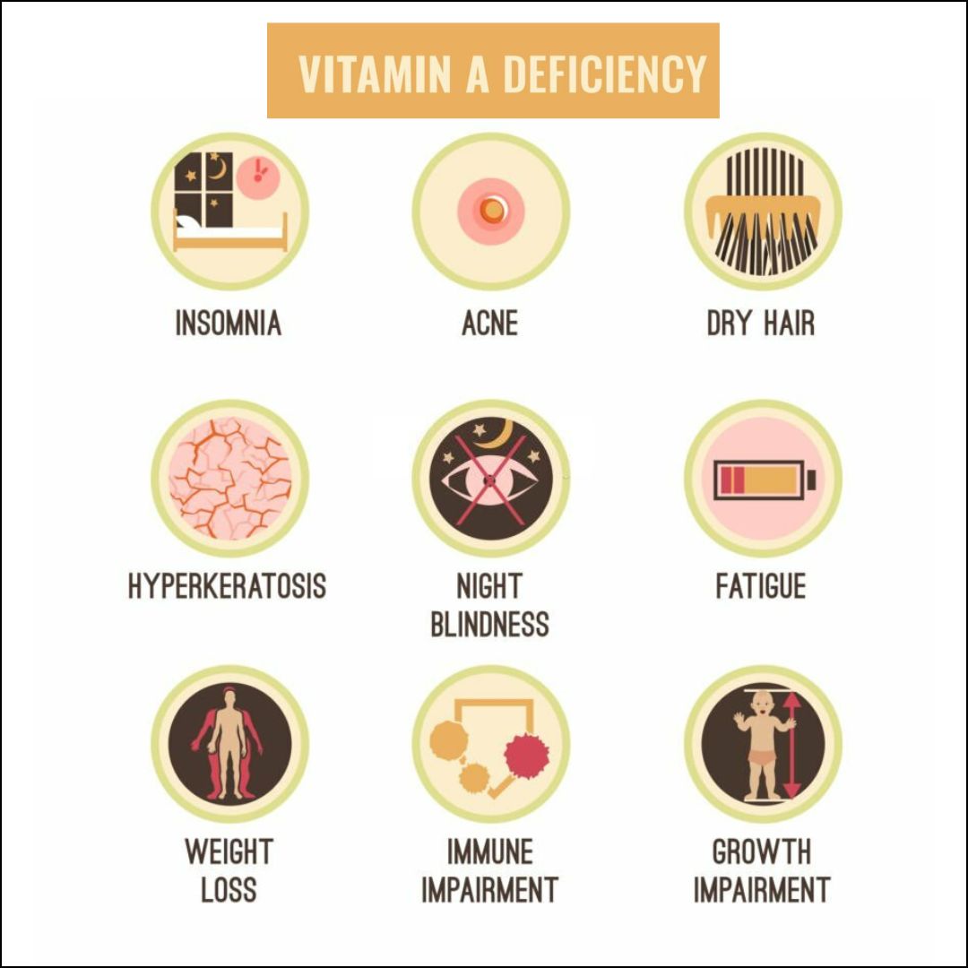 What Are The Signs Of Vitamin Deficiencies In Adults